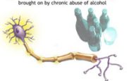 Alcohol and Nerves